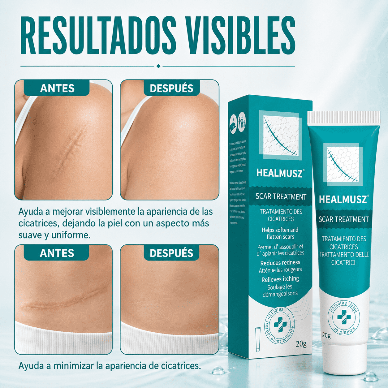 Crema cicatrizante / cicatrices / antici